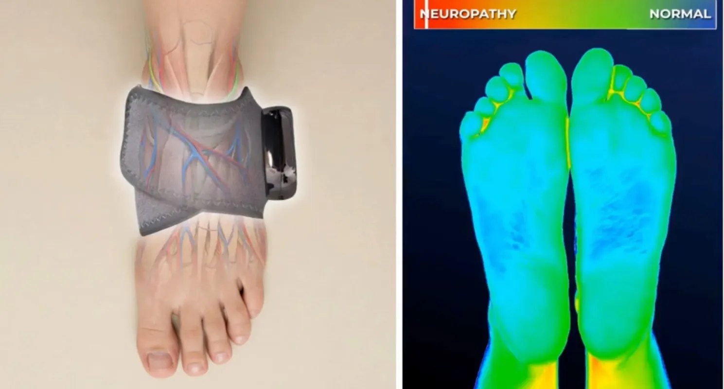 EMSense au pied et image thermique des pieds